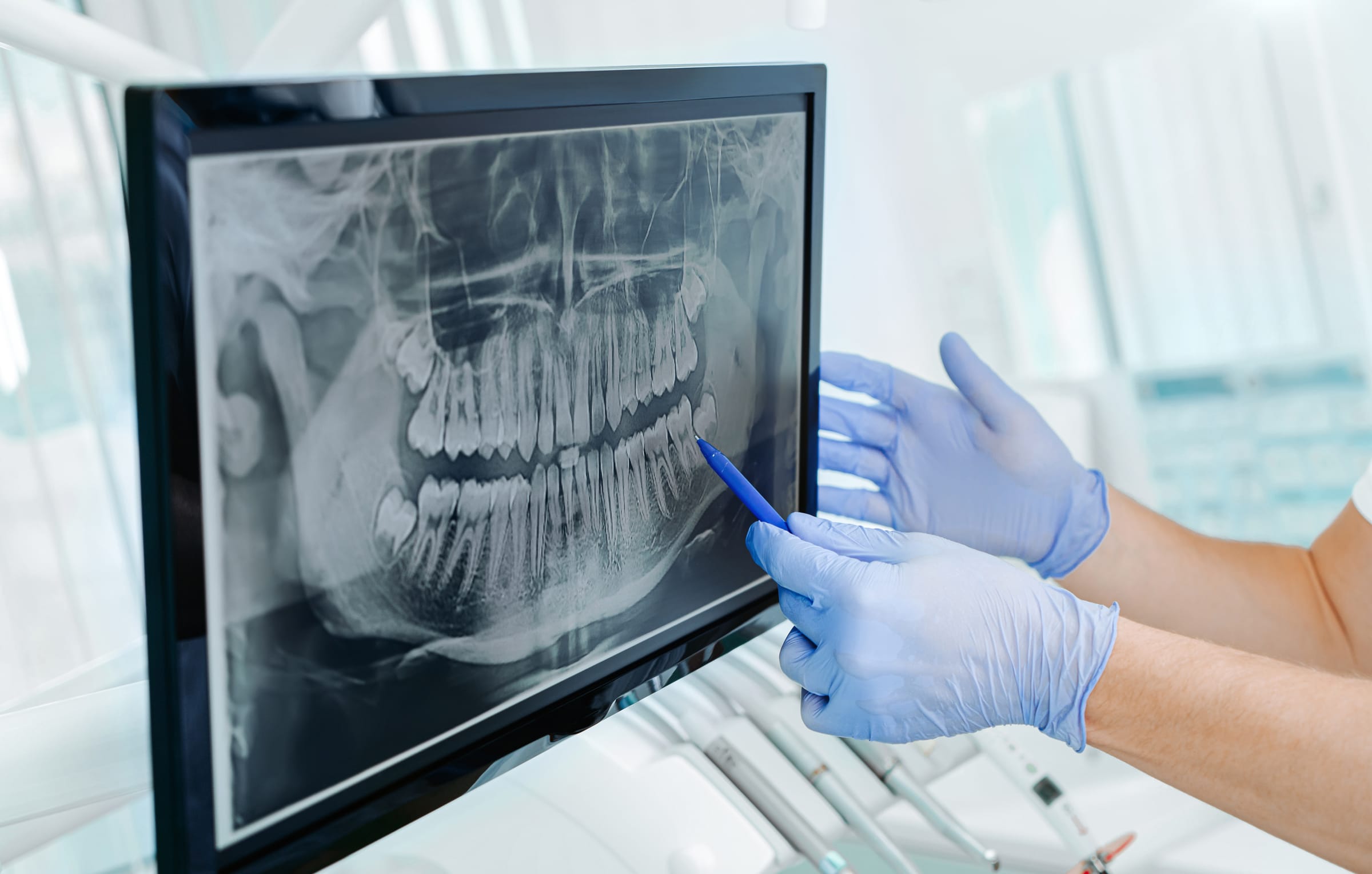 Low-Radiation Digital X-Rays