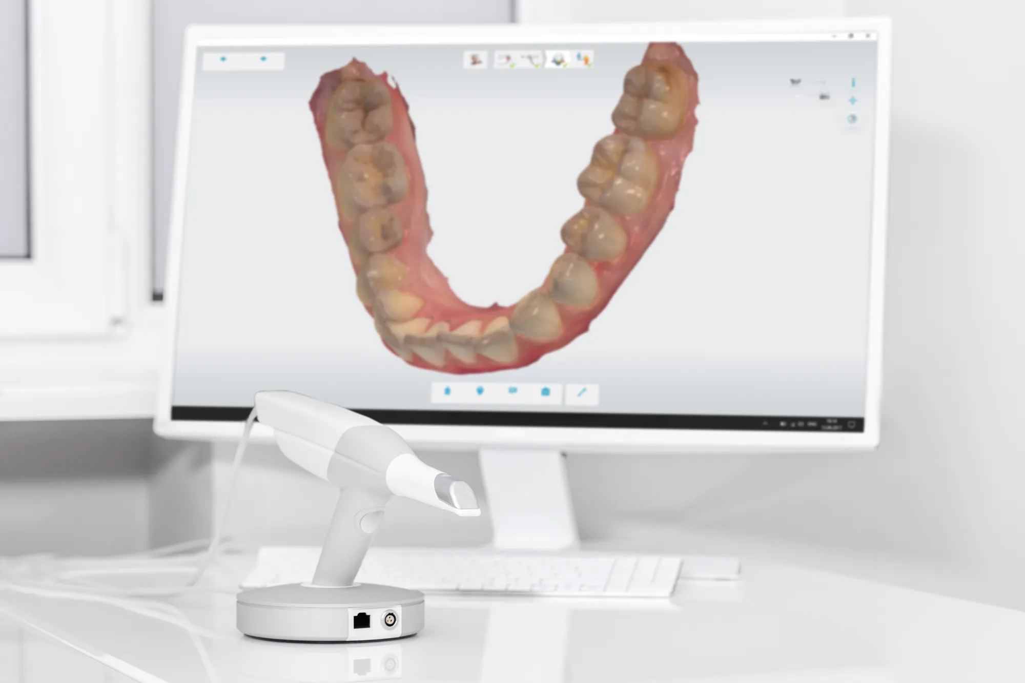 Upper Dental implant treatment room in Hollywood, FL