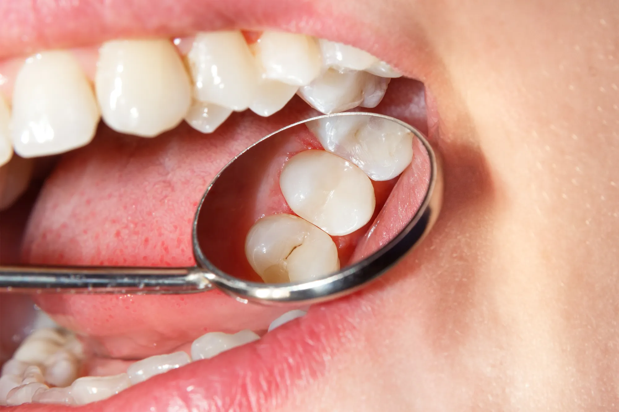 Sala de tratamiento de cuidado preventivo de Upper Dental en Hollywood, FL