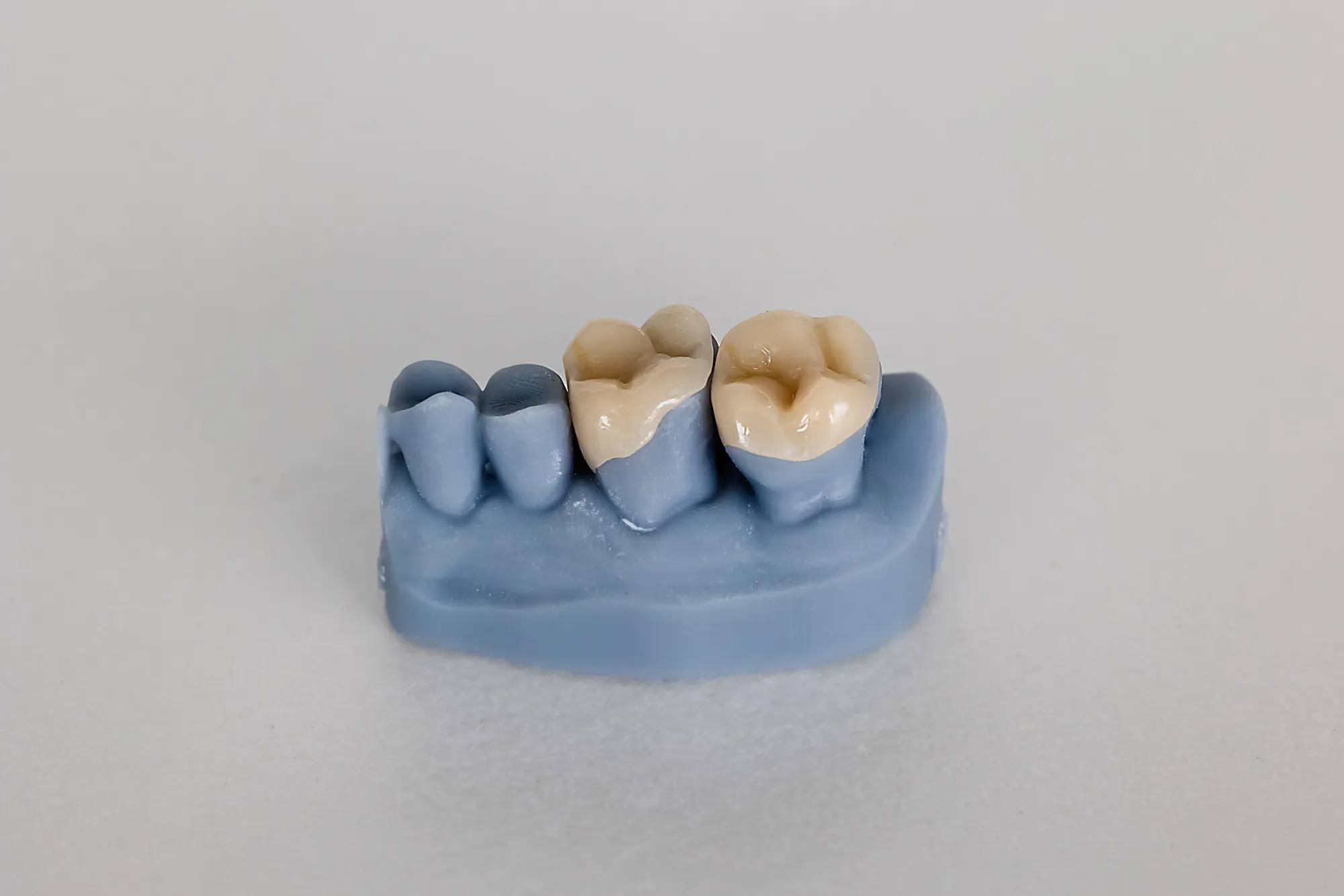 Upper Dental restorative treatment room