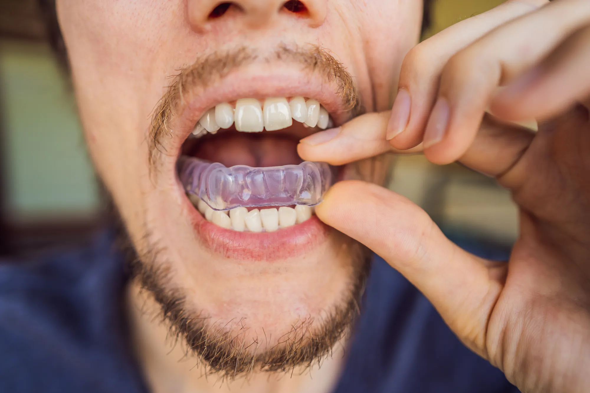 Sala de tratamiento de cuidado preventivo de Upper Dental en Hollywood, FL