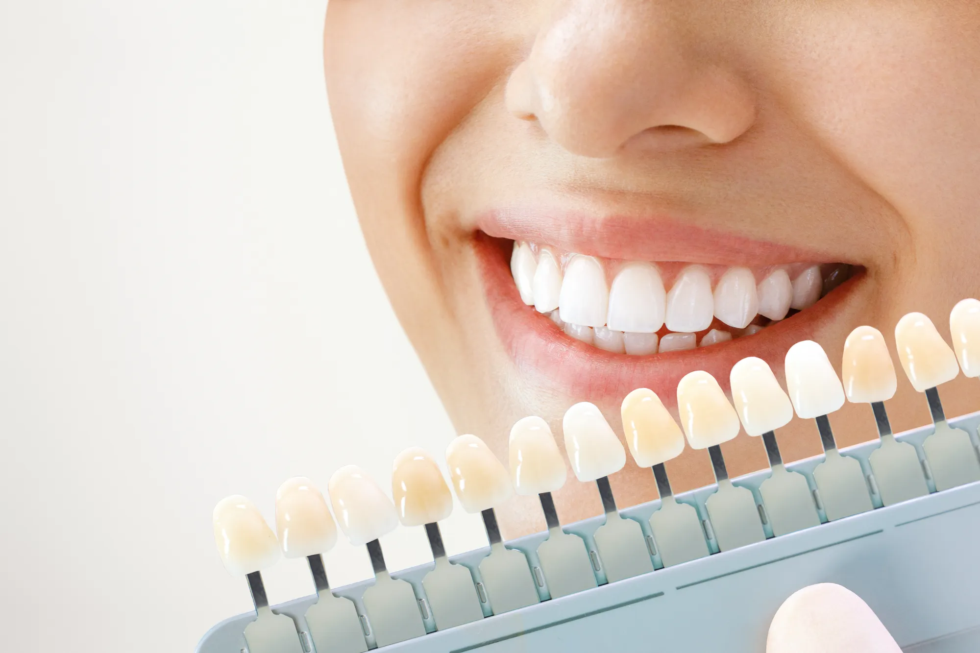 Sala de tratamiento cosmético de Upper Dental